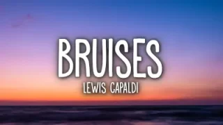 Lewis Capaldi Bruises Lyrics